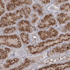 Anti-ADCK2 antibody produced in rabbit 