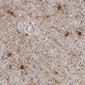 Anti-ADCK5 antibody produced in rabbit 