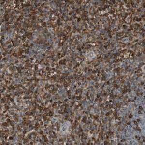 Anti-ADCY10 antibody produced in rabbit 