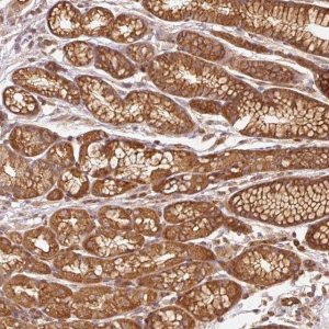 Anti-ADCY4 antibody produced in rabbit 