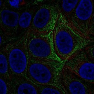 Anti-ADCY5 antibody produced in rabbit 
