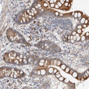 Anti-ADCY8 antibody produced in rabbit 