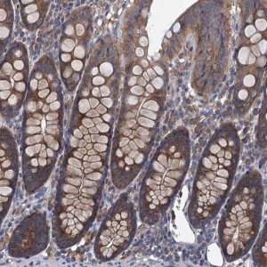 Anti-ADCY9 antibody produced in rabbit 