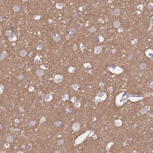 Anti-ADD2 antibody produced in rabbit 