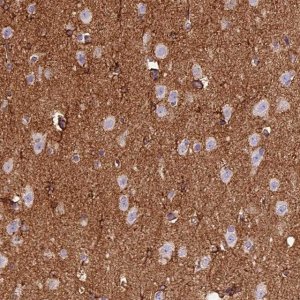 Anti-ADD3 antibody produced in rabbit 