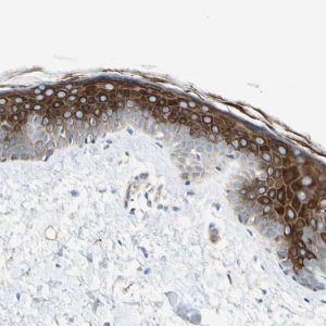 Anti-ADGRA3 antibody produced in rabbit 