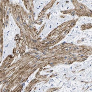 Anti-ADGRG6 antibody produced in rabbit 