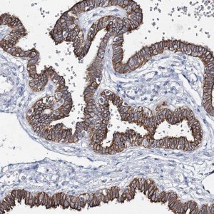 Anti-ADGRL1 antibody produced in rabbit 
