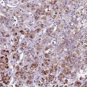 Anti-ADGRV1 antibody produced in rabbit 