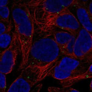 Anti-ADGRV1 antibody produced in rabbit 