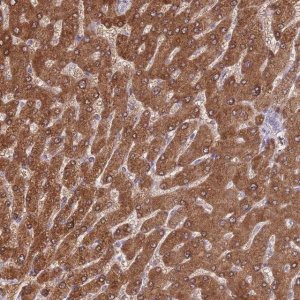 Anti-ADH1A antibody produced in rabbit HPA047814-100UL