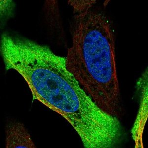 Anti-ADH1A antibody produced in rabbit HPA047814-100UL