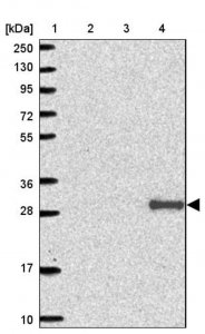 Anti-ADIPOQ antibody produced in rabbit HPA051767-100UL