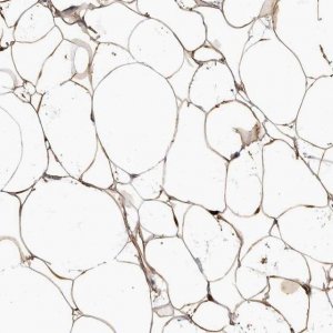 Anti-ADIRF antibody produced in rabbit 