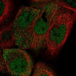 Anti-ADIRF antibody produced in rabbit 