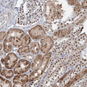 Anti-ADK antibody produced in rabbit 