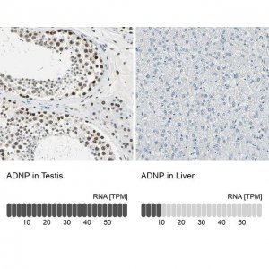 Anti-ADNP antibody produced in rabbit 