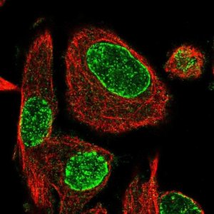 Anti-ADPRH antibody produced in rabbit 