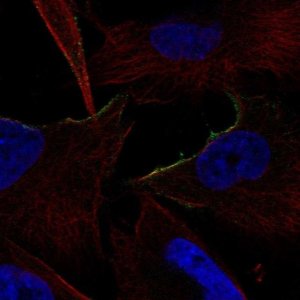 Anti-ADRA1B antibody produced in rabbit 