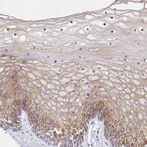 Anti-ADRA2C antibody produced in rabbit 