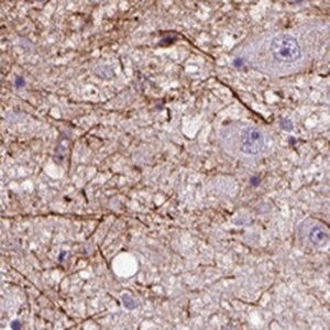 Anti-ADRB3 antibody produced in rabbit 