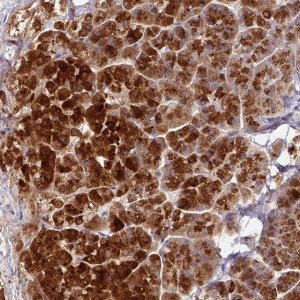 Anti-AEBP2 antibody produced in rabbit 