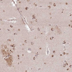 Anti-AF165138.7 antibody produced in rabbit 
