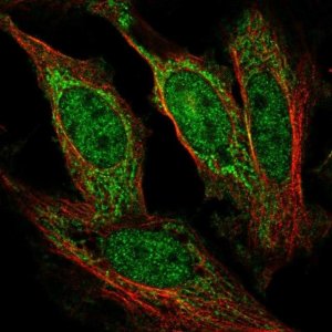 Anti-AFF1 antibody produced in rabbit 