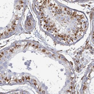 Anti-AGAP1 antibody produced in rabbit 