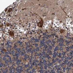 Anti-AGAP2 antibody produced in rabbit 