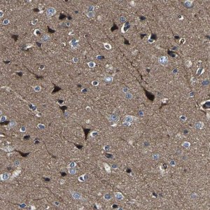 Anti-AGAP3 antibody produced in rabbit 