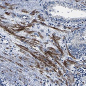 Anti-AGAP3 antibody produced in rabbit 