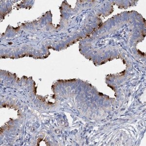 Anti-AGBL4 antibody produced in rabbit 