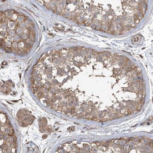 Anti-AGBL5 antibody produced in rabbit 