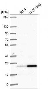Anti-AGER antibody produced in rabbit 