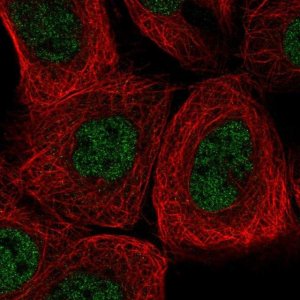 Anti-AGL antibody produced in rabbit 
