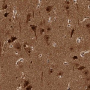 Anti-AKT3 antibody produced in rabbit 