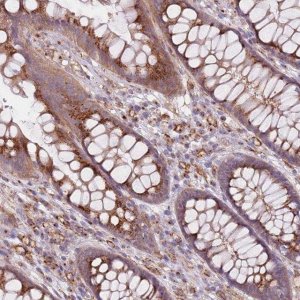 Anti-AKTIP antibody produced in rabbit 