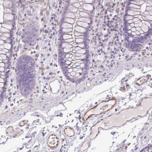 Anti-AL592183.1 antibody produced in rabbit 