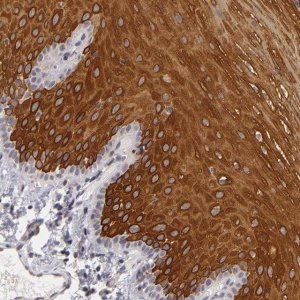 Anti-ALAS2 antibody produced in rabbit 