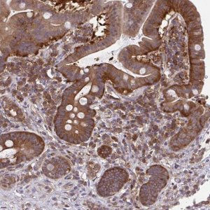 Anti-ALDH16A1 antibody produced in rabbit 