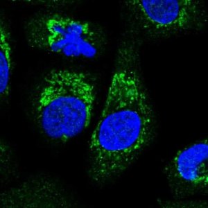 Anti-ALDH16A1 antibody produced in rabbit 