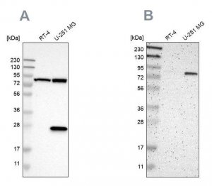 Anti-ALDH18A1 antibody produced in rabbit 