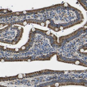 Anti-ALDH18A1 antibody produced in rabbit 