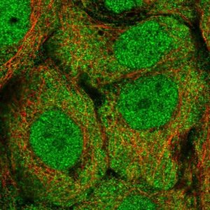 Anti-ALDH1A3 antibody produced in rabbit 