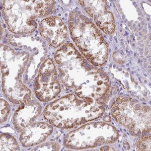 Anti-ALDH2 antibody produced in rabbit HPA051065-100UL