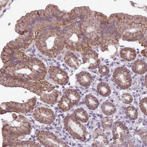Anti-ALDH2 antibody produced in rabbit HPA051065-100UL
