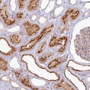 Anti-ALDH3B1 antibody produced in rabbit 