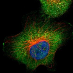 Anti-ALDOA antibody produced in rabbit 
