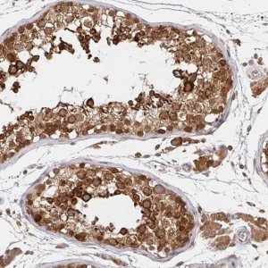 Anti-ALG1 antibody produced in rabbit 
